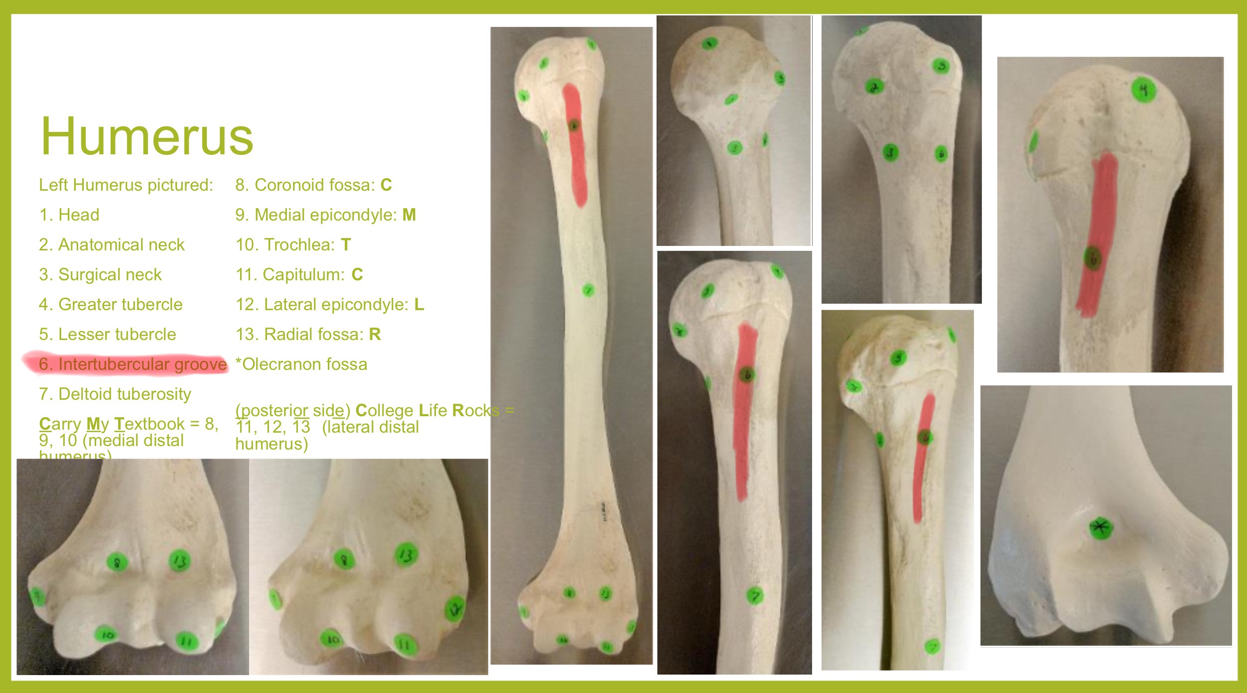 <p>bicipital groove of humerus</p>