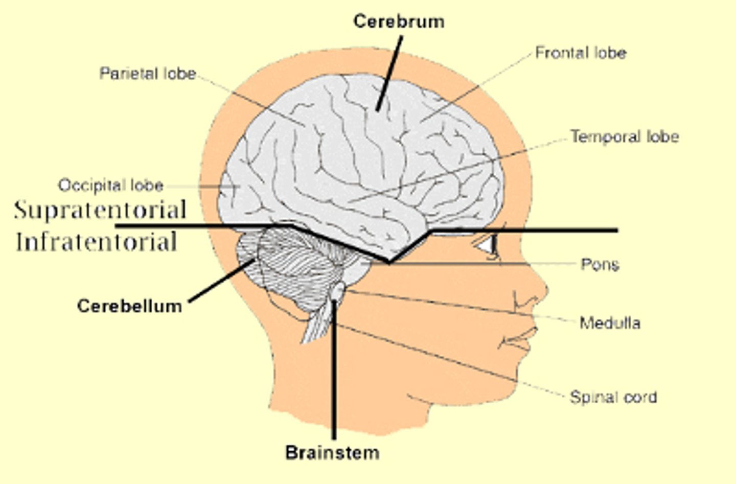 <p>caused by lesions that affect both cerebral hemispheres OR the brainstem reticular activating system.</p><p>1. Supratentorial causes</p><p>2. Brainstem lesions (infratentorial)</p><p>3. Diffuse encephalopathies</p>