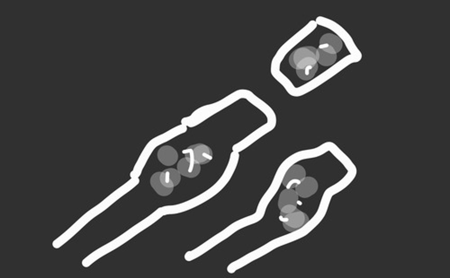 <p>presents in the extremities and is benign</p><p>what does this represent? (more than one)</p>