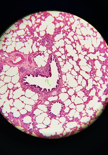 <p>what is outlined?</p>