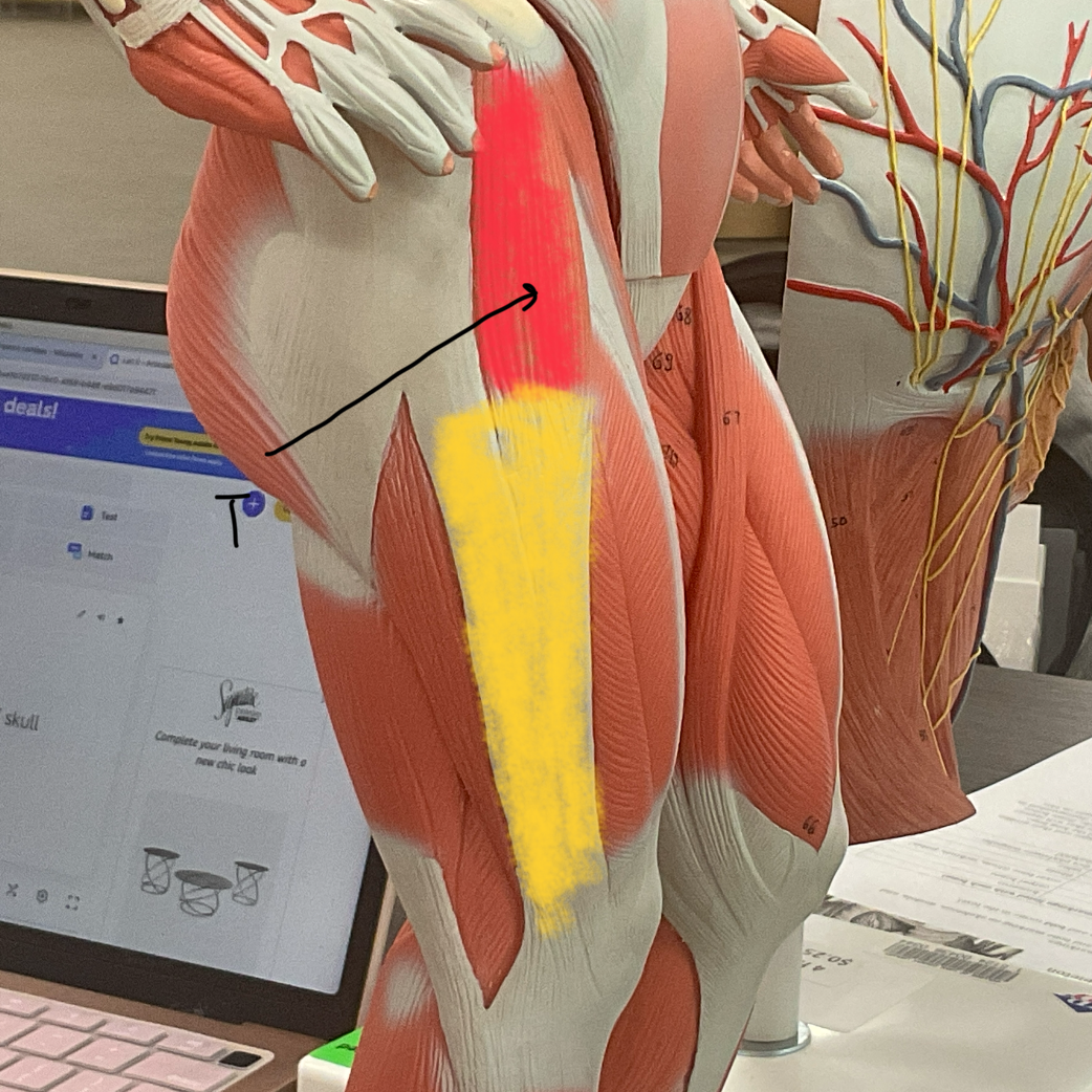 <p>Red = T</p><p>Yellow = I</p>