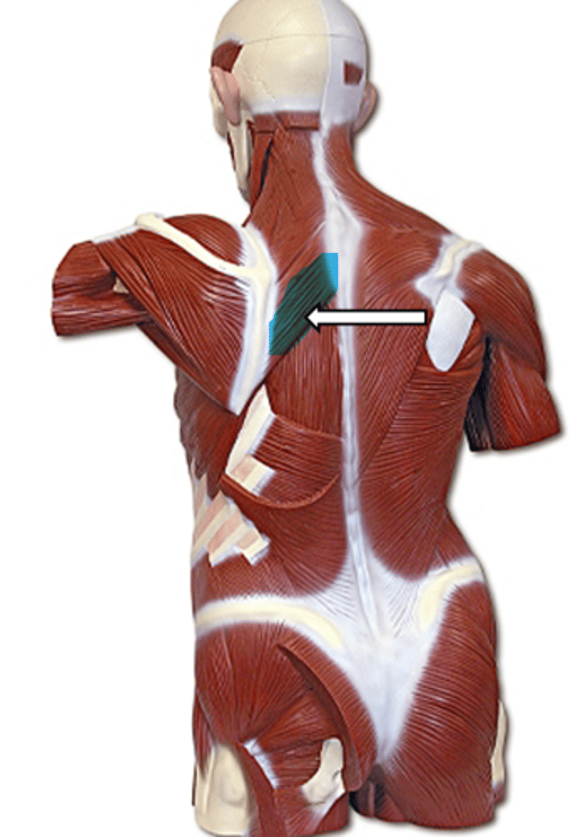 <p>name the muscle</p>