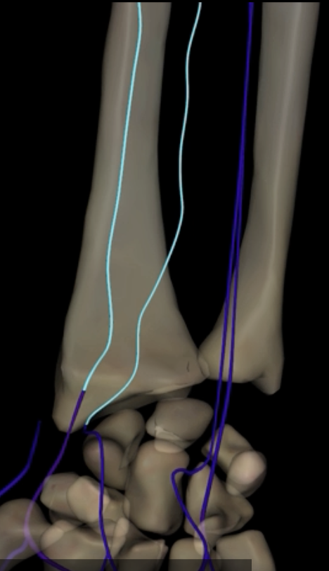 <p>What is highlighted in blue?</p>