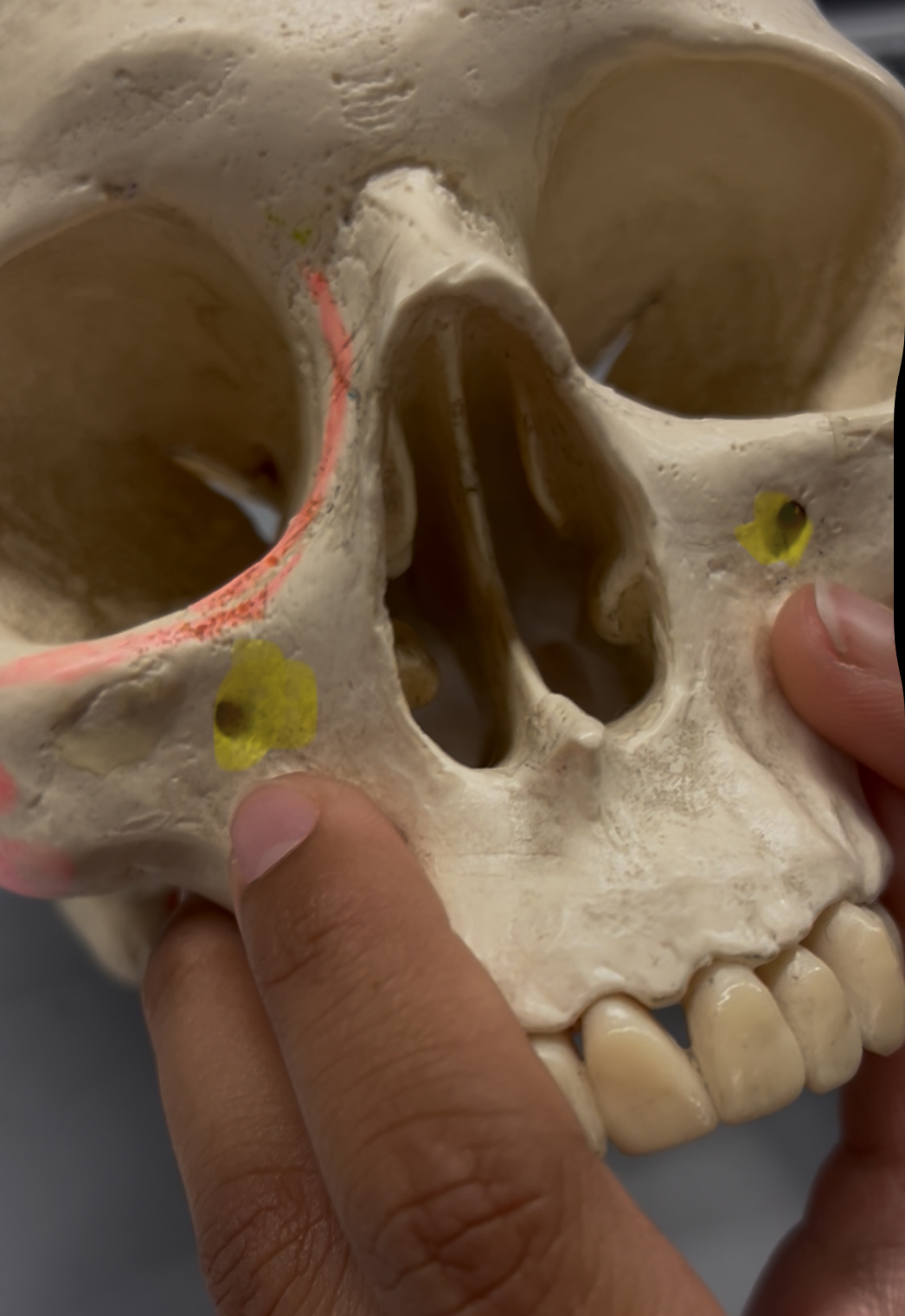 <p>What foramina is labeled by the yellow highlight? What bones are the located? Also, which if any cranial nerves pass through there?</p>