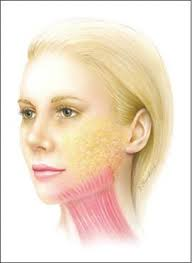 <p>what facial expression bone is this?</p>