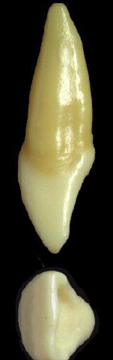 <p>what tooth is this &amp; why?</p>