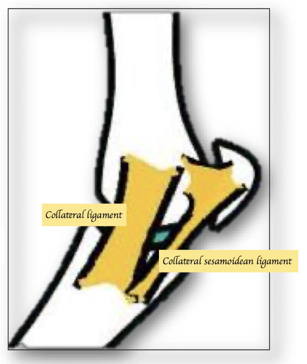 <p>Collateral sesamoidean ligaments </p>