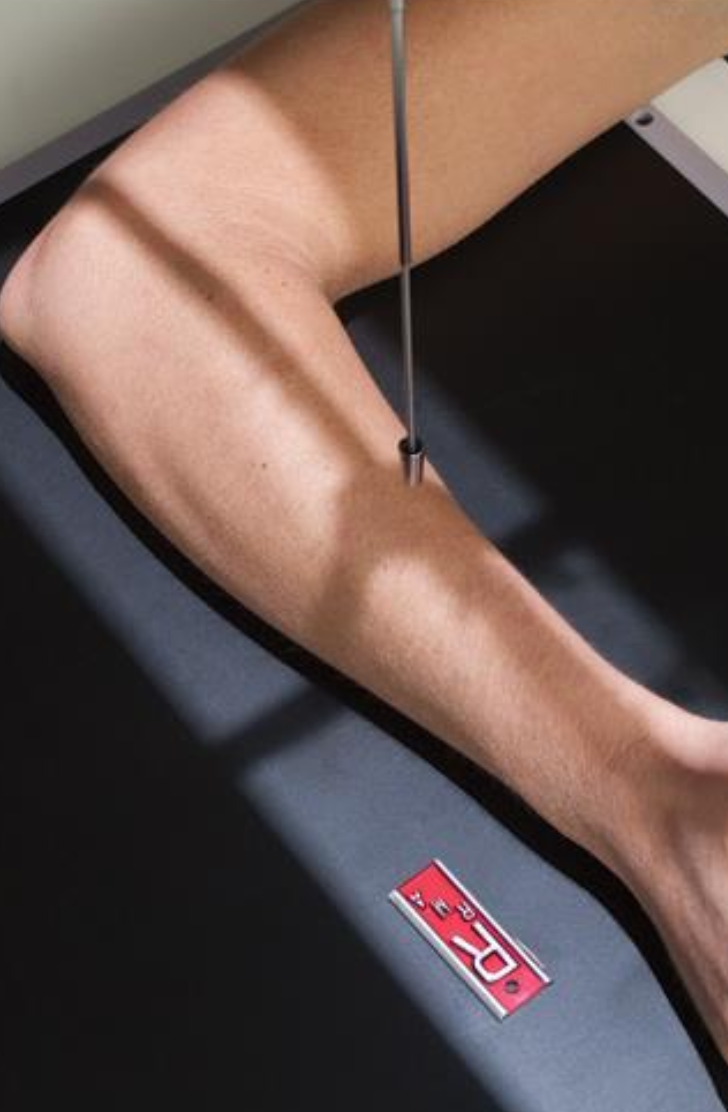 <p>lateral forearm</p>