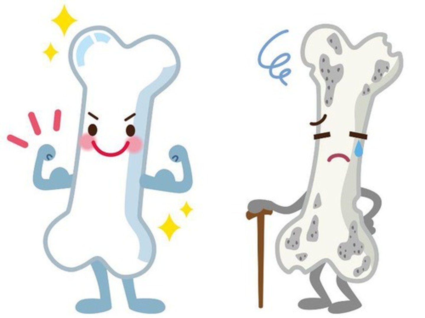 <p>Osteoporosis is a demineralization of the bone caused by a lack of weight-bearing activity; exercise helps move calcium back into the bone, strengthening it.</p>