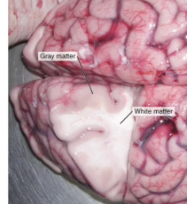 <p>In the CNS, what are bundles of axons called? (White Matter)</p>