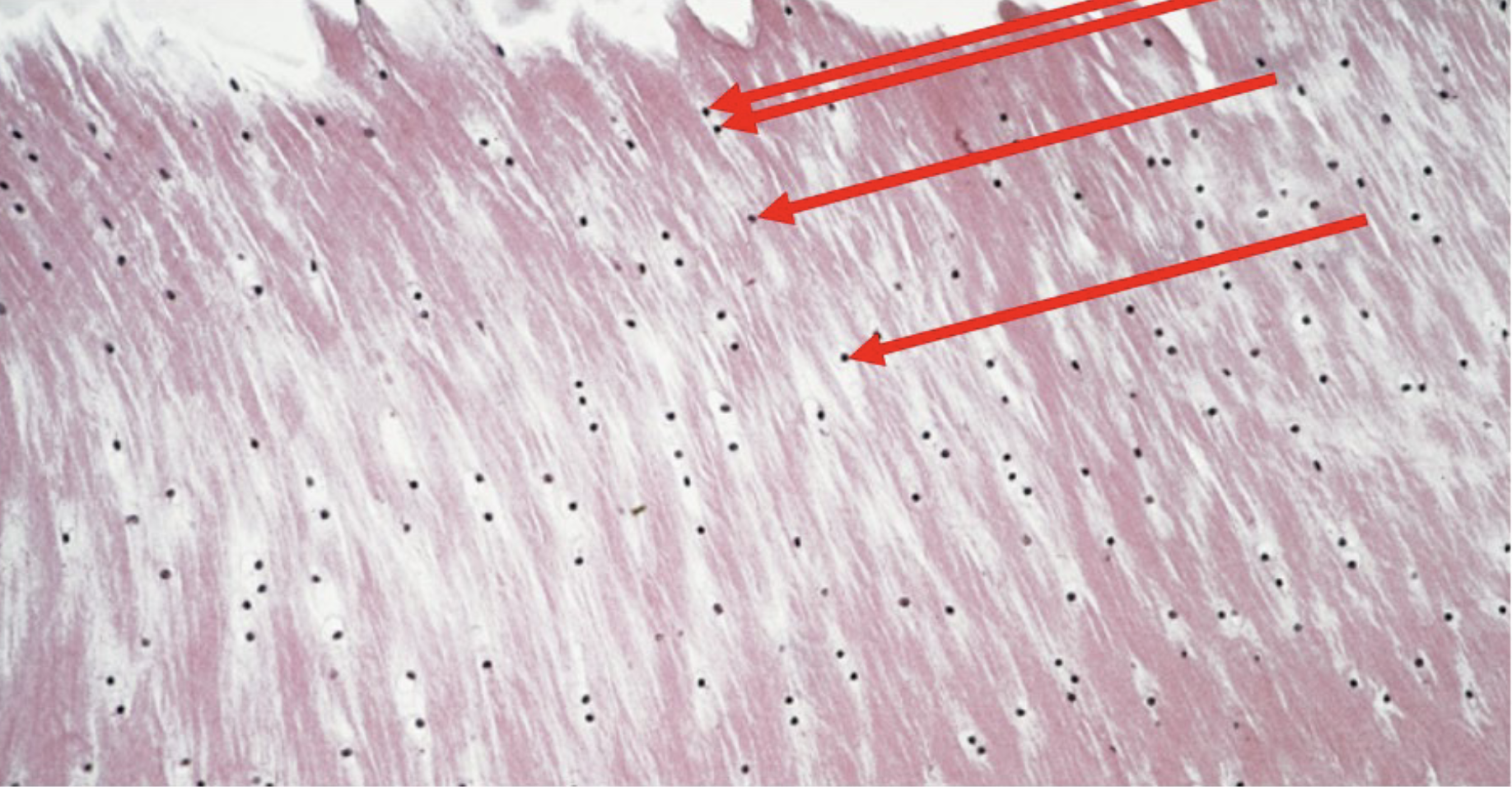 <p>What is the arrow point at? - hint inside</p>