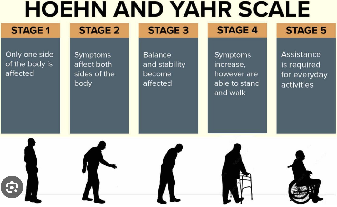 <ol start="3"><li><p>may be able to live independently and continue employment</p></li></ol><p></p><p><span data-name="cross_mark" data-type="emoji">❌</span>1—rollator use is stage 4</p><p><span data-name="cross_mark" data-type="emoji">❌</span>2—WC use is stage 5</p><p><span data-name="cross_mark" data-type="emoji">❌</span>4—balance not impaired with stages 1/2</p><p></p><p></p>