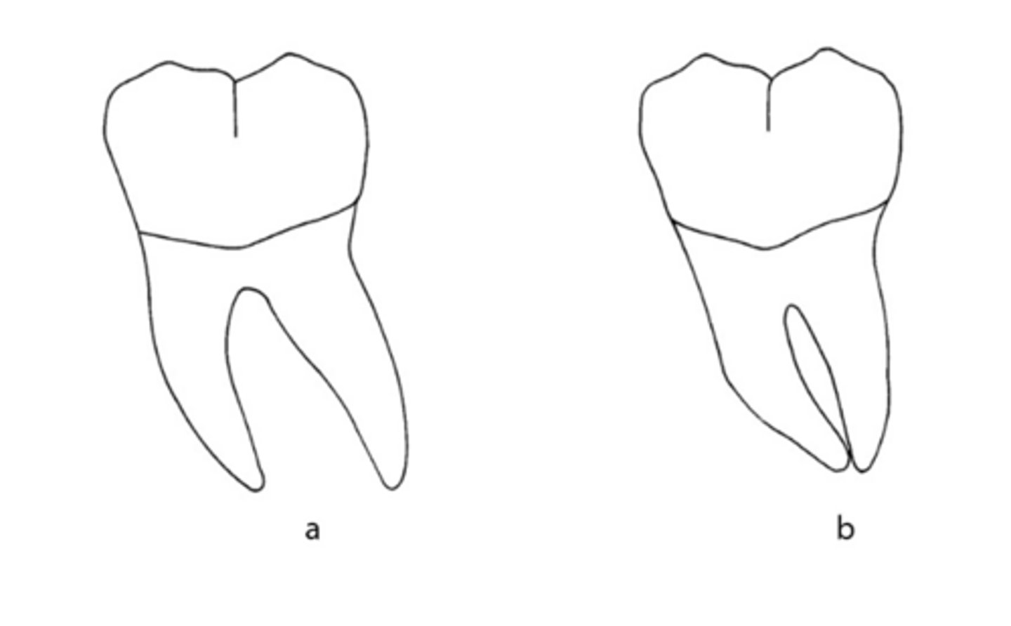 <p>What root configuration is a superior choice for an abutment: A or B?</p>