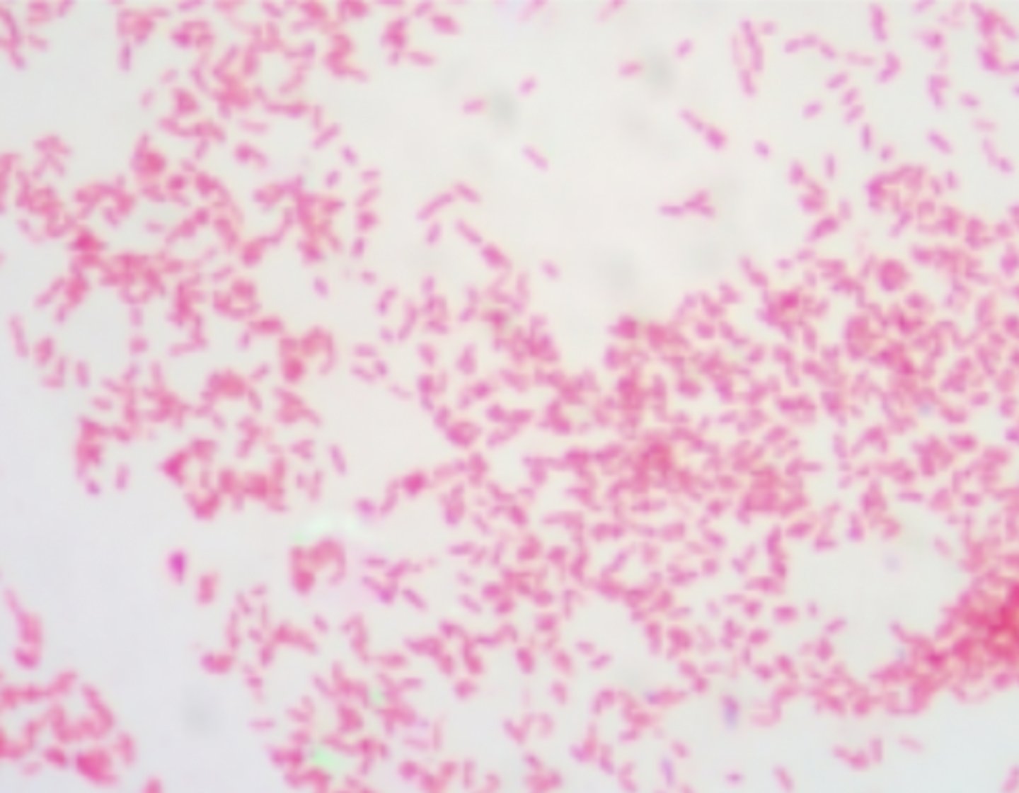 <p>Interpret the following gram stain reaction and describe the morphology</p>
