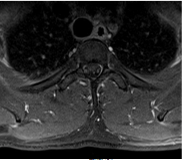 <p>What weighting is this image? How can you tell?</p>