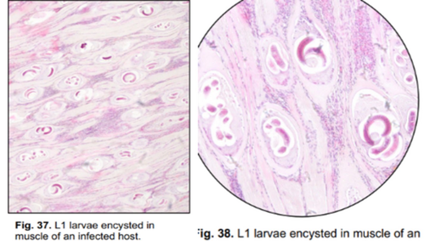 <p>Trichinelloidea that infects the SI in a wide range of mammalian hosts (including humans) & some avian spp.</p><p>-Adults are very small with a stichosome esophagus</p><p>-Nurse cells encapsulate & protect the L1s in muscle</p>