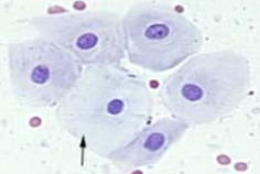 <p>Intermediate cells</p>