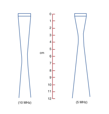 <p>increases </p>