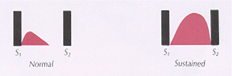 <p>first 2/3s</p>