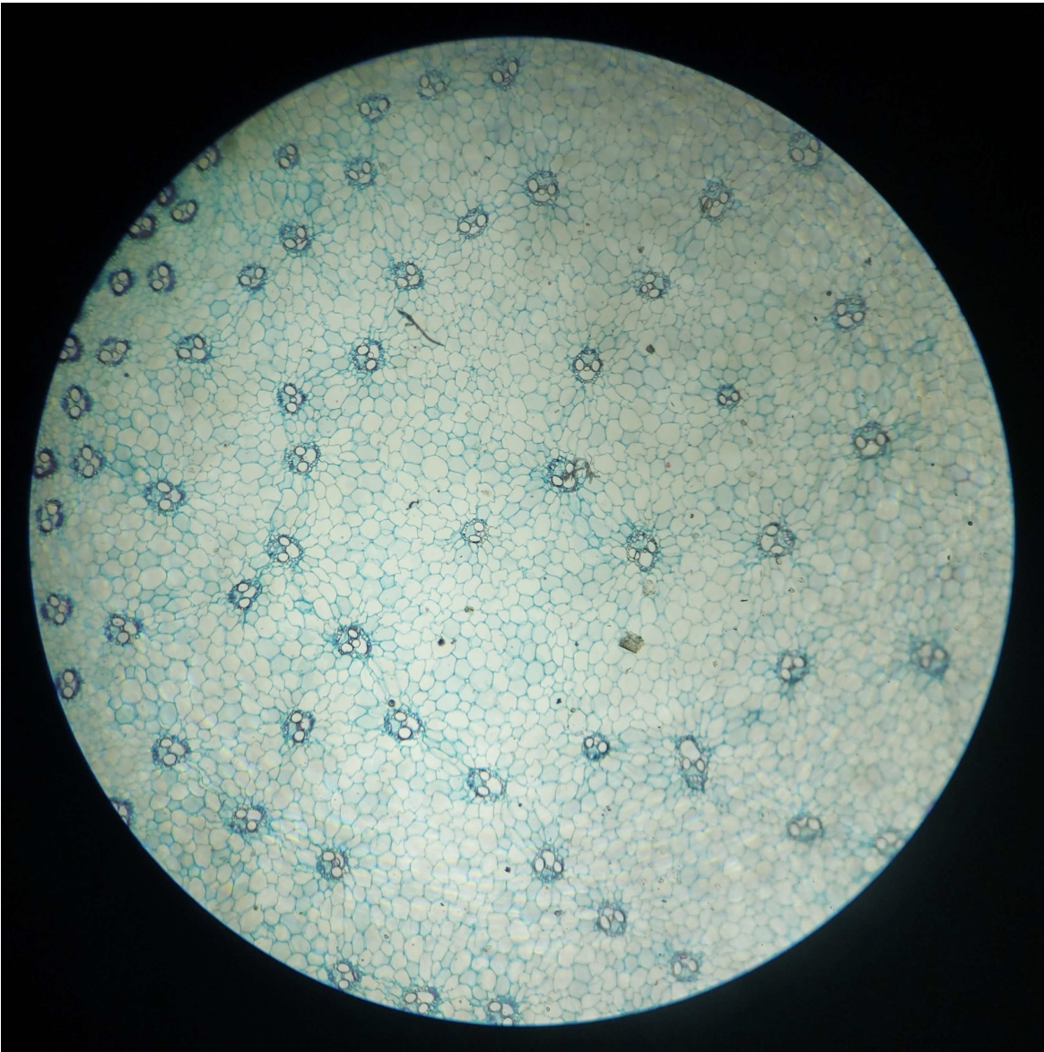<p>Vascular Bundle</p>