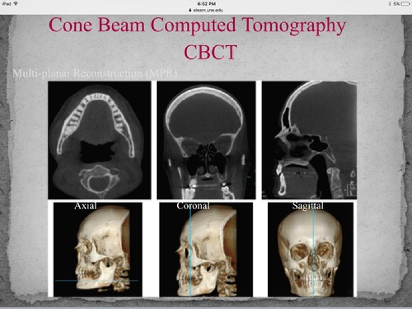 <p>three dimensional digital imaging method that uses a cone-shaped beam of radiation that rotates around the patient</p>