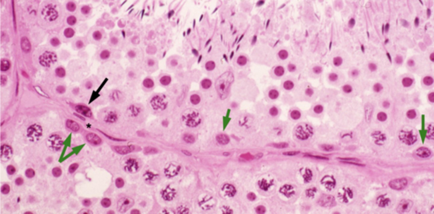 <p>What is the starred cell representing?</p>
