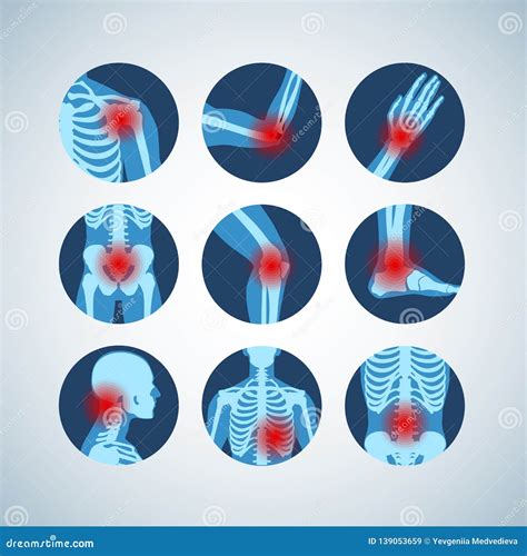 <p>arthro (root)</p>
