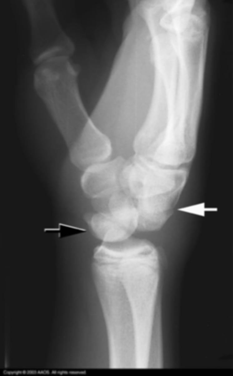 <p>What is the issue?</p>