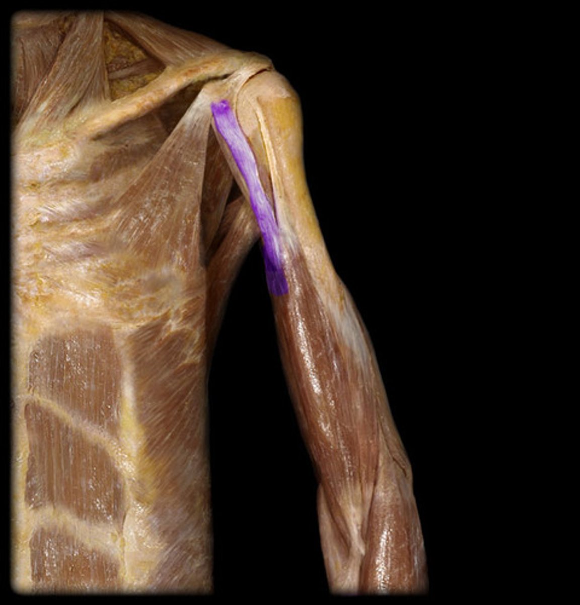 <p>Action: Weakly flexes the forearm at the humeroulnar j.</p><p>P: Coracoid process of scapula b.</p><p>D: radial tuberosity and bicipital aponeurosis of the radius b.</p>