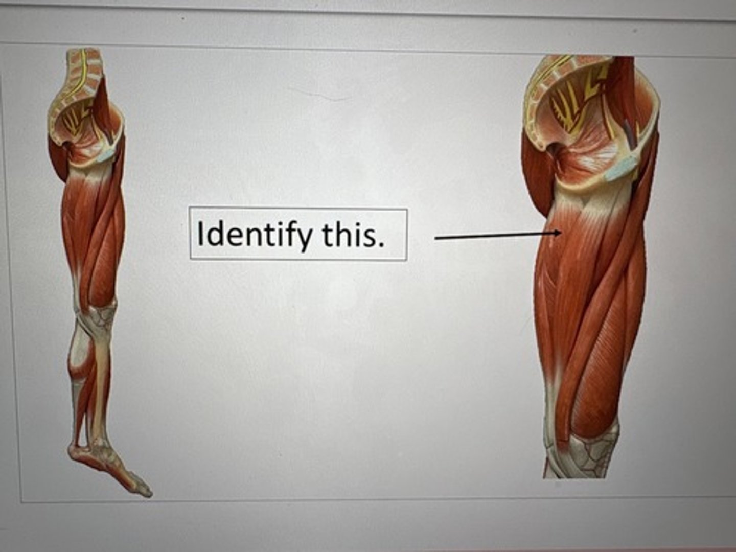 term image