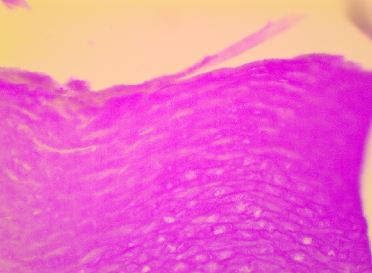 <p><span>Found in the epidermis of skin</span></p>