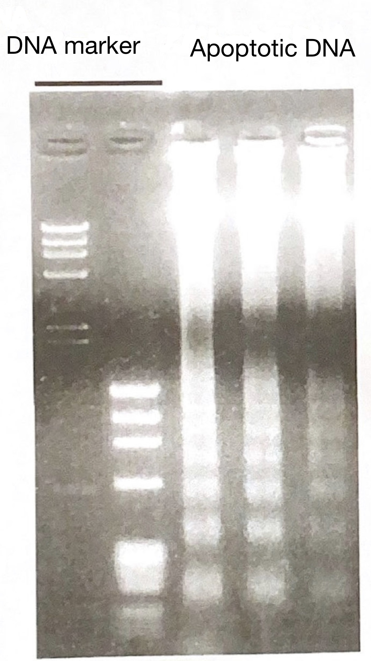 <p>702</p><p>The figure shows the result of agarose electrophoresis of the DNA of apoptotic cells.</p><p>Step ladder is  integral multiple of how many base pairs?</p><p></p><p>a 90</p><p>b 180</p><p>c 270</p><p>d 360</p><p>e 450</p>