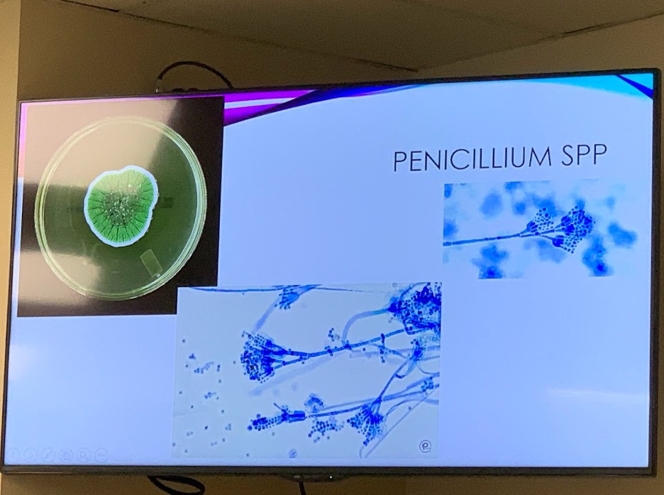 <p>Colony and microscopic morphology of: Penicillium</p>