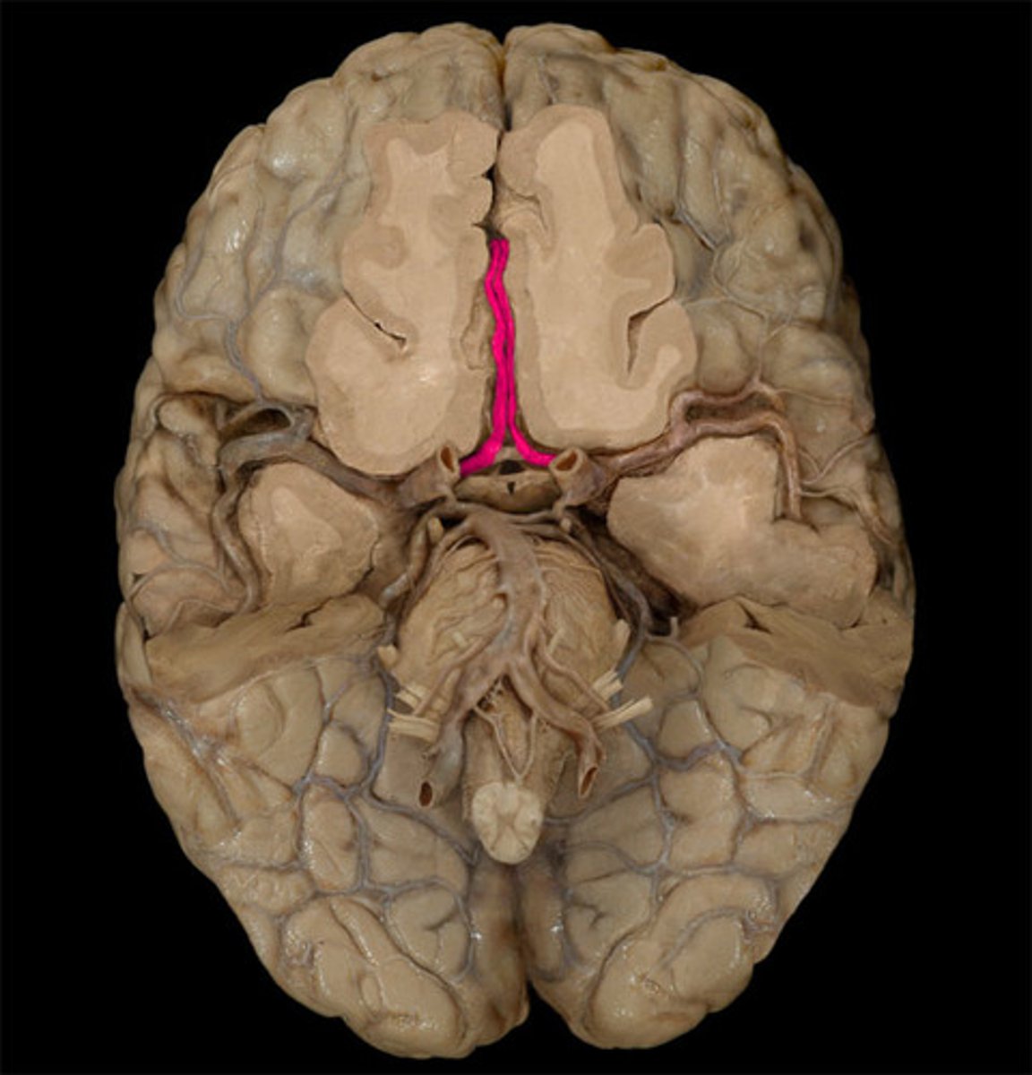 <p>Courses anteriorly and medially</p><p>Sits within the longitudinal fissure</p><p>Courses backwards over the corpus callosum</p>