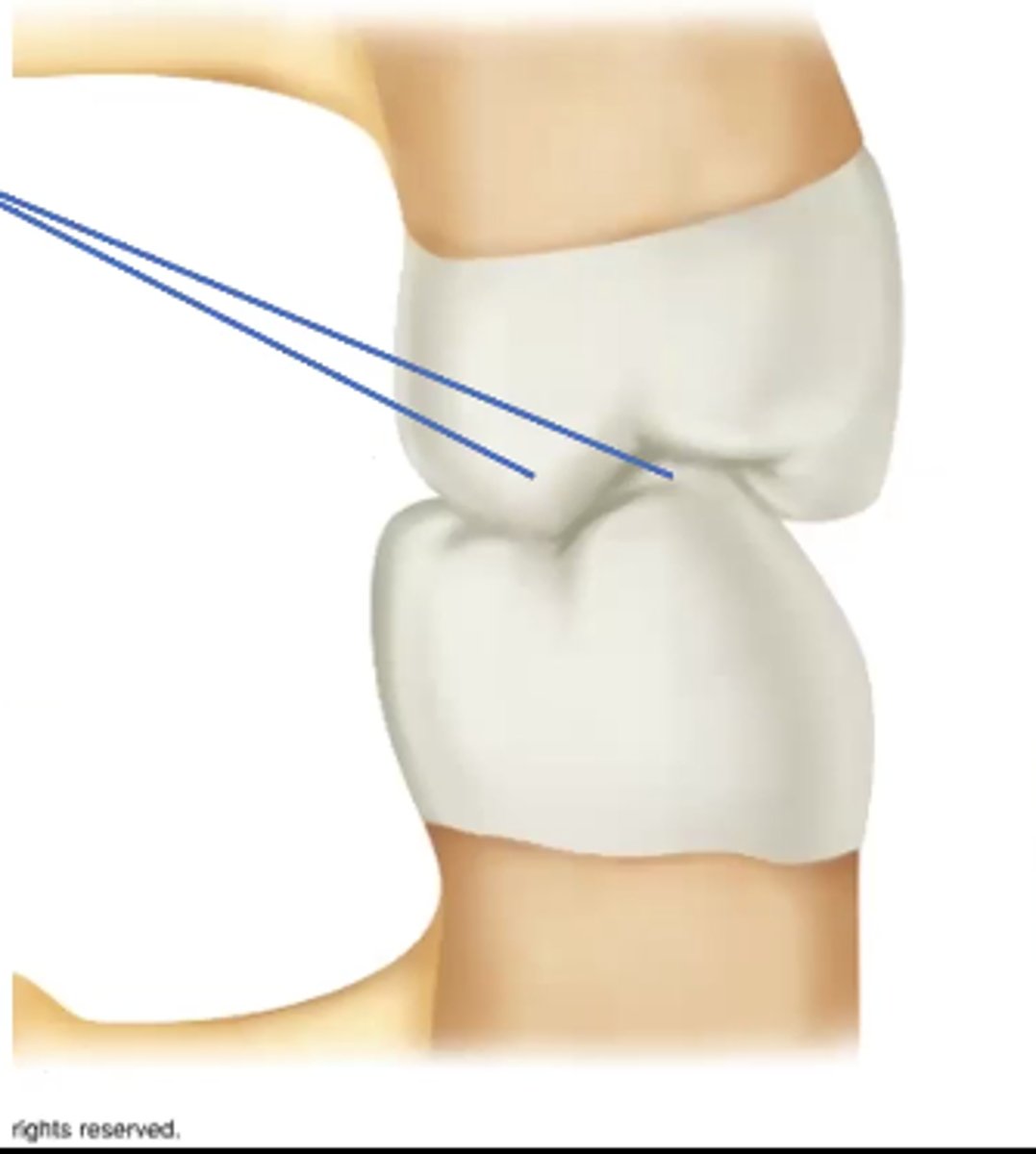 <p>Identify the occlusal relationship:</p>