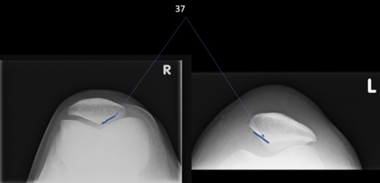 <p>ID 37 (joint)</p>