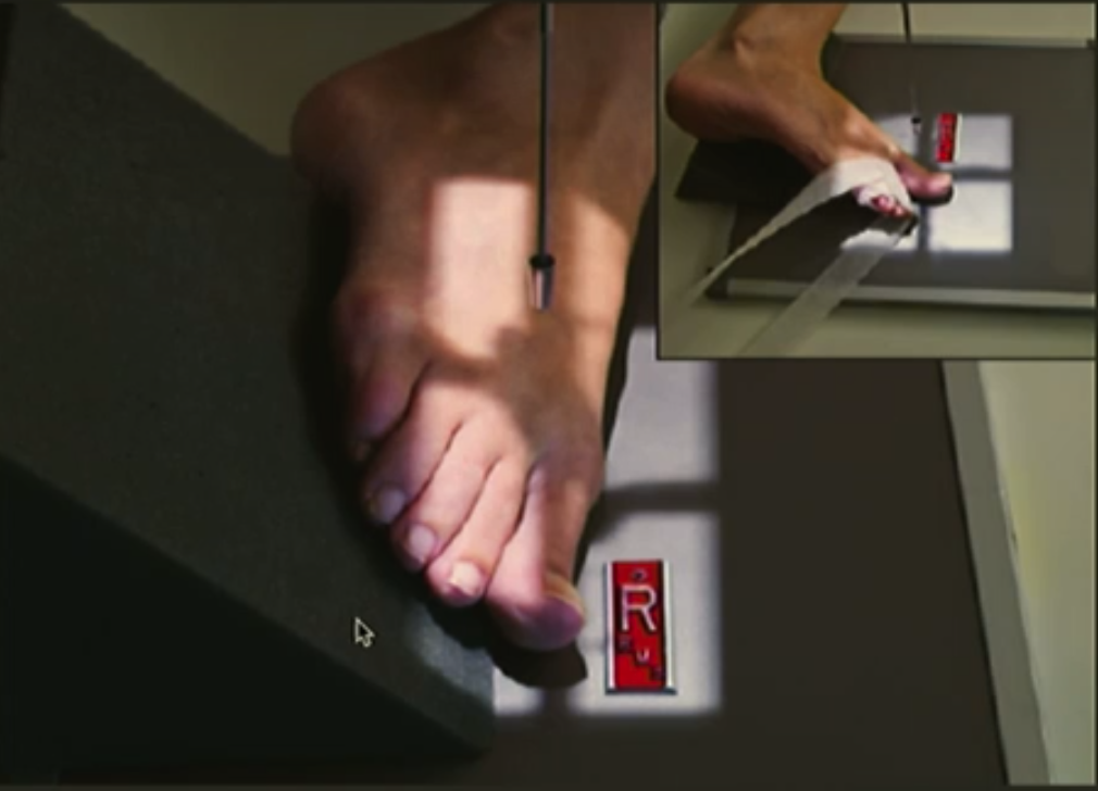 <ul><li><p>Long axis of foot parallel to IR.</p></li><li><p>Start AP toes, rotate 30-40 degrees internal.</p></li><li><p>CR perpendicular to IR.</p></li><li><p>Centre at MTP joint of interest.</p></li><li><p>Collimate for skin edge distally and MT base proximally.</p></li><li><p>Include part of toes either side.</p></li></ul><p></p>