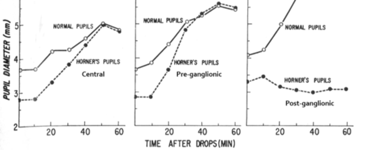 <p>cocaine drop bc cocaine blocks re-uptake of NE at the nerve terminal, and hydroxyamphetamine works by being absorbed into nerve and forcing NE out</p>