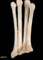 <p>Metatarsals</p>