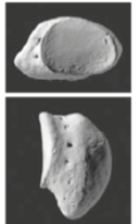 <p>Smallest carpal bone that is round in shape</p>