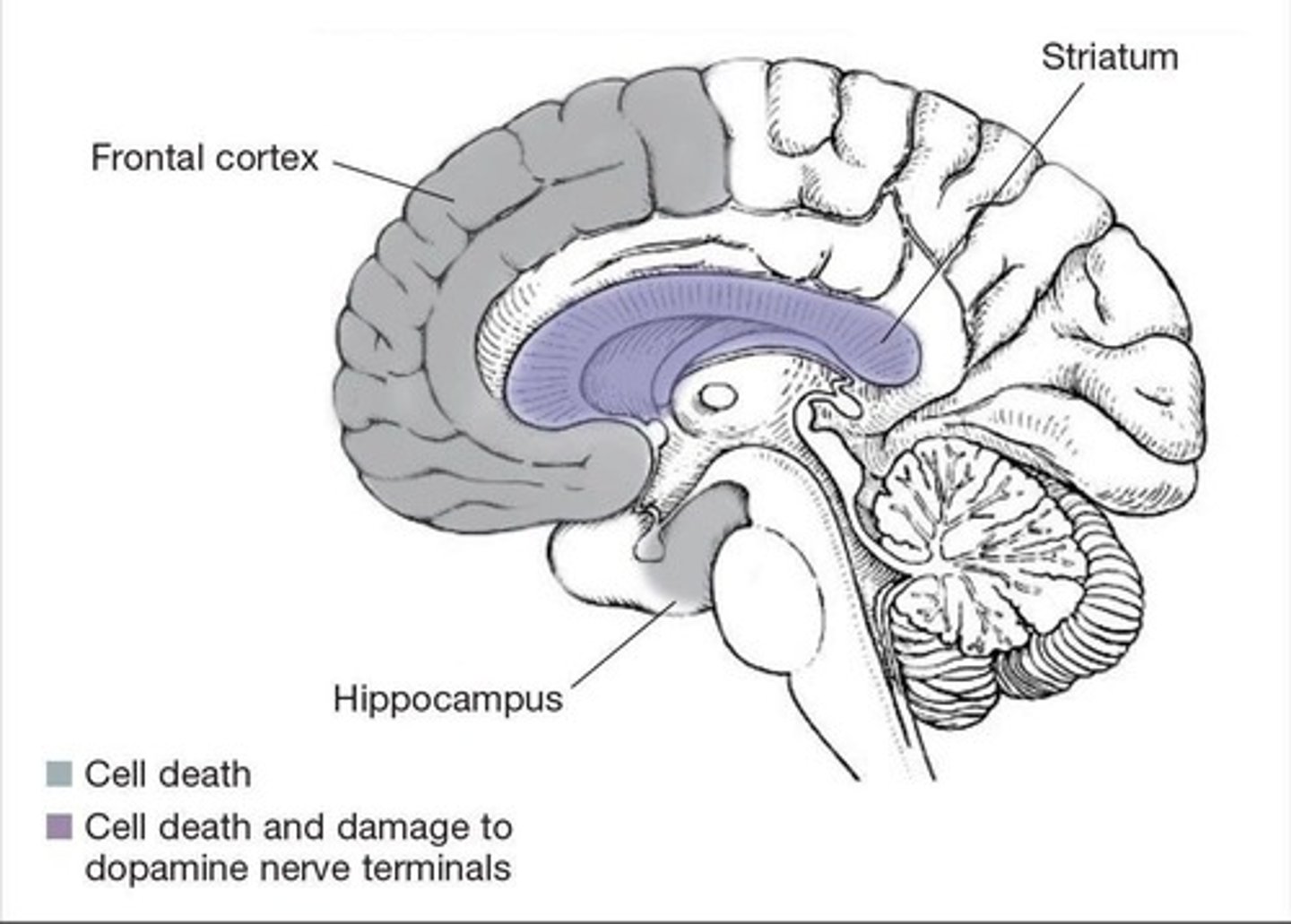 <p>Damages dopamine and serotonin axons.</p>
