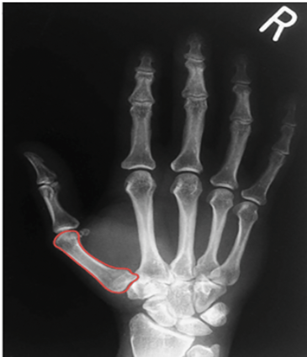 <p>What structure is highlighted?</p>
