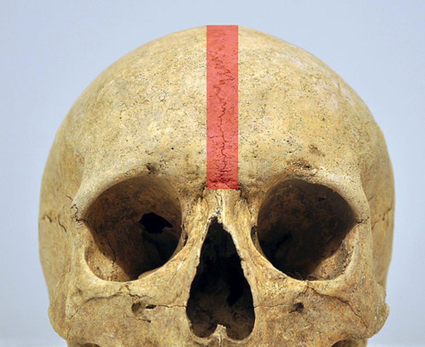 <p>- panel content</p><p>- immovable</p><p>- fused bone</p><p>- ex: sternum and coxal bones</p>