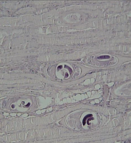 <p>Trichinella spiralis </p>
