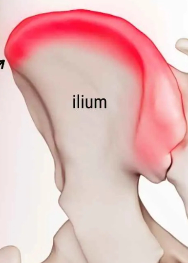 <p>Prominent ridge</p>