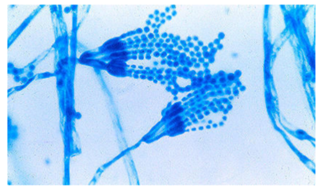 <p>What is the <strong>genus name</strong> of this organism + and its <strong>asexual spore</strong> structure?</p>