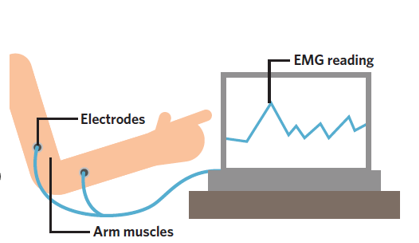 <ul><li><p>It detects, amplifies, and records the electrical activity of the body’s muscles</p></li></ul><p></p>