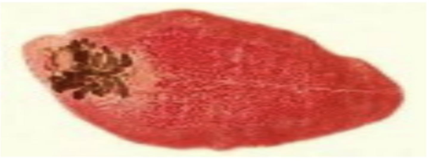 <p>Fasciola (sheep fluke) - Trematoda</p>