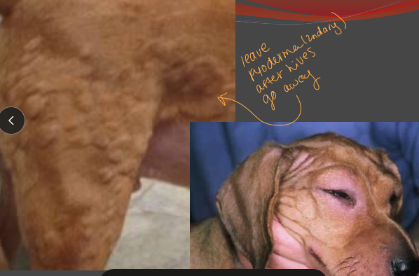 <p><span>Urticaria &amp; Angioedema</span></p>