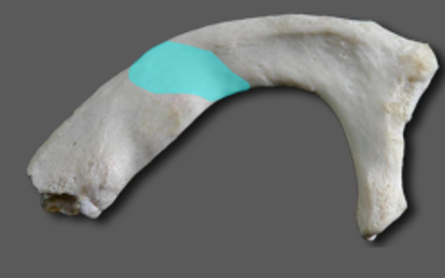 <p>Rib 1</p><p>Immediately posterior to the scalene tubercle on the upper surface of the first rib</p>